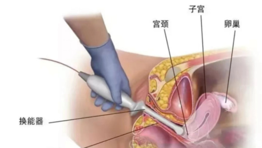 2O24澳彩管家婆资料水果爷爷,梅西说在巴黎的两年每天都不开心,机构预测与落实方法揭秘_优选版V15.86